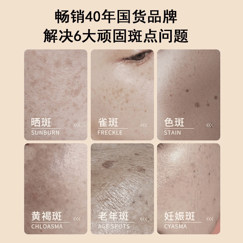 片仔癀祛斑霜美白淡化黑色素老年黄褐雀晒斑烟酰胺去黄提亮肤色男女面霜 1瓶【美白淡化】