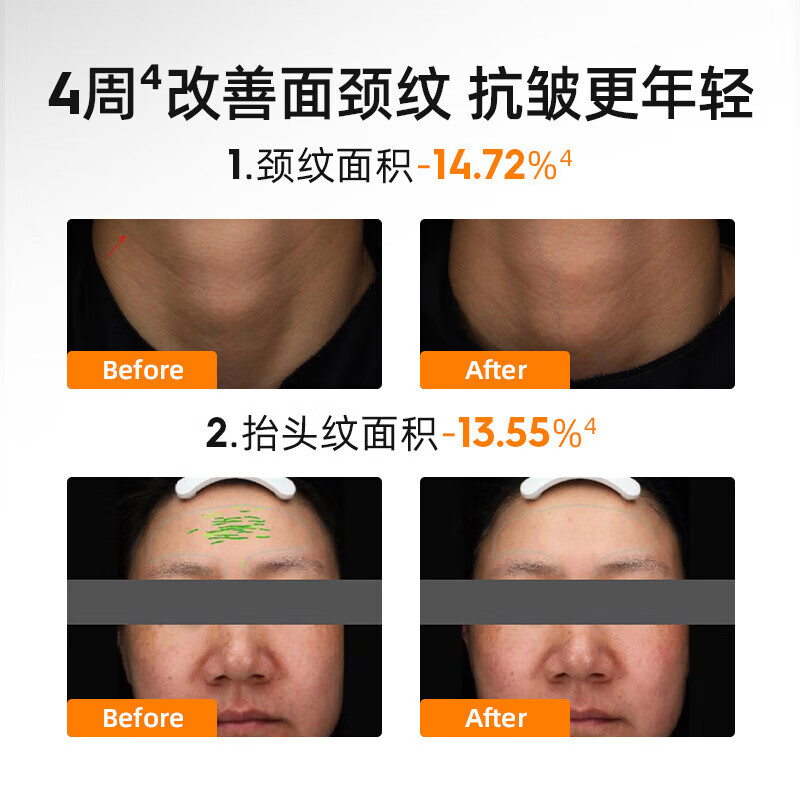绽媄娅【临期27年11月】贴骨Pro面霜2.0抗皱紧致淡化细纹 保湿乳液面霜 贴骨Pro面霜50g+30g+3片贴骨面膜