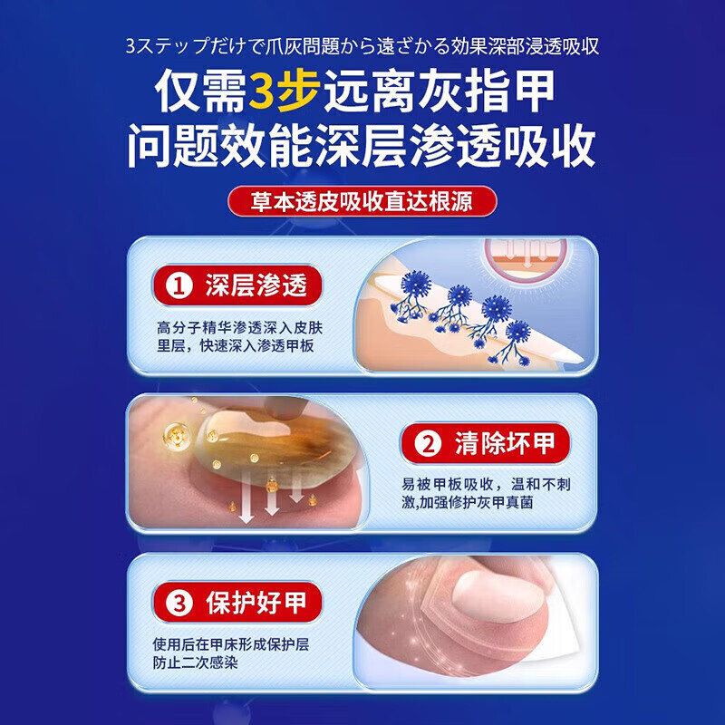 久研制药日本灰指甲特傚效药第1名正品增厚发黄变空中沟草炎药进口抑菌液 一瓶【体验装】