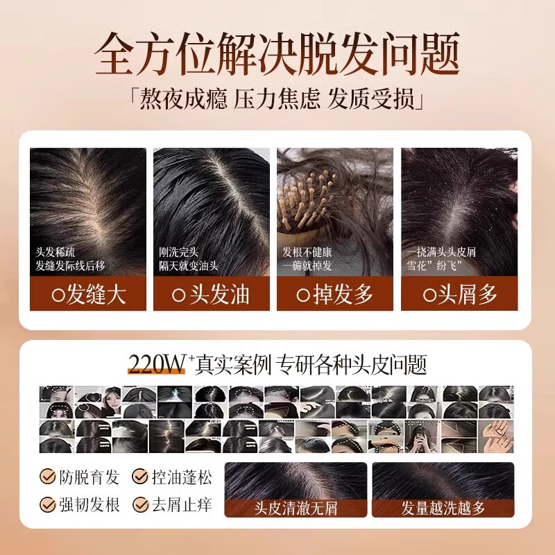 七味堂防脱洗发水胖东来严选生姜育发洗发露增长头发旗舰控油去屑固发店 5瓶装【毛囊滋养】健发丰盈