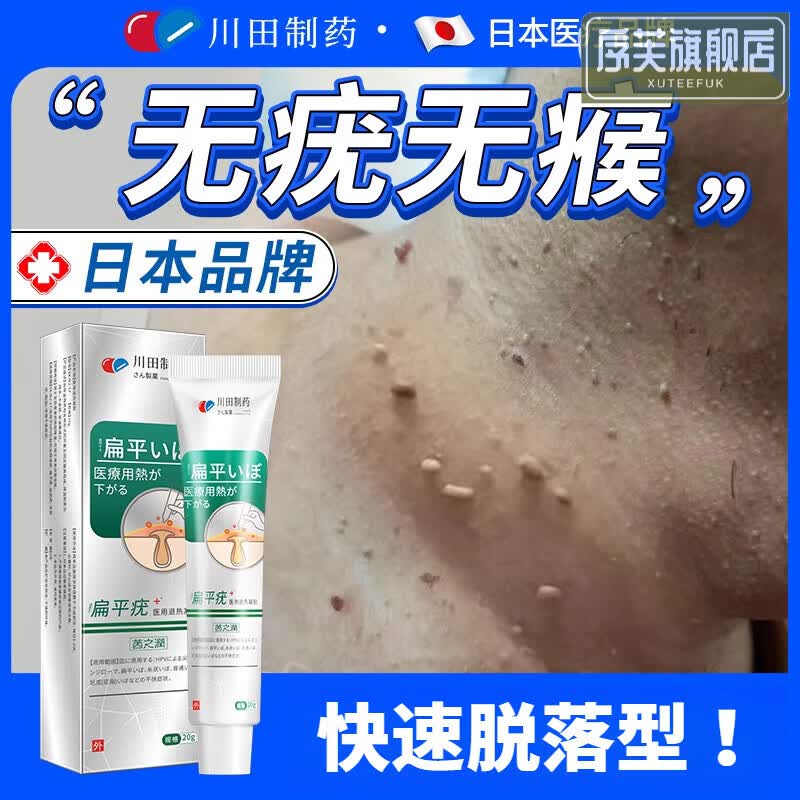 诠语水杨酸软药膏去疣专用膏药日本进口面部脖子刺瘊子肉