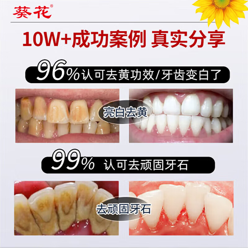 葵花美白牙膏去口臭去黄去牙渍去烟渍牙垢十大知名品牌含氟护龈 4支【7天去黄去渍-有效真测】