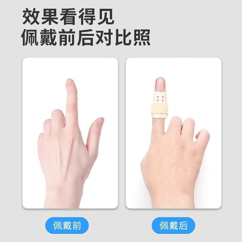 医用手指弯曲矫正器骨折固定指套夹板支具关节变形支架锤状指护具 5号/60-65mm[建议成人大拇指| S-适用小指/拇指/儿童手指
