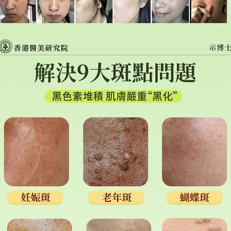示博士香港面霜三七柿叶霜猪油版细腻嫩滑改善暗沉祛斑保湿提亮柿叶子霜 三盒 【重度老斑 晒斑 雀斑】