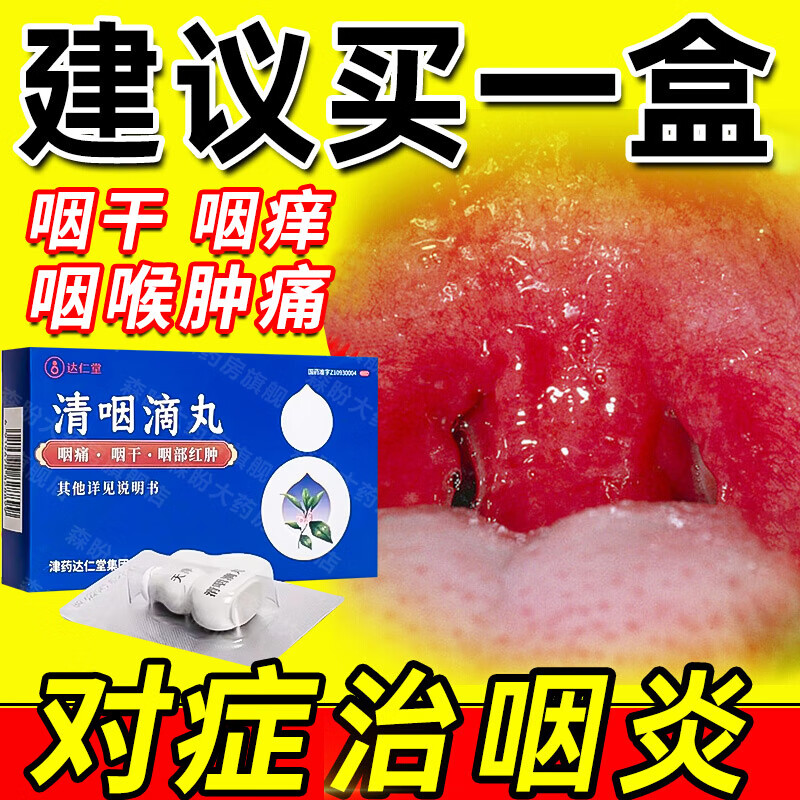 慢性咽喉炎咽炎中药喉咙痒干咳异物感咽喉肿痛干痒滤泡增生咽喉壁淋巴