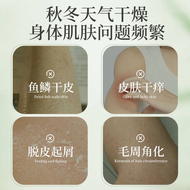 百年扁氏艾草止痒润肤露乳液 保湿滋润干燥起皮补水身体乳男女通用 买1发2
