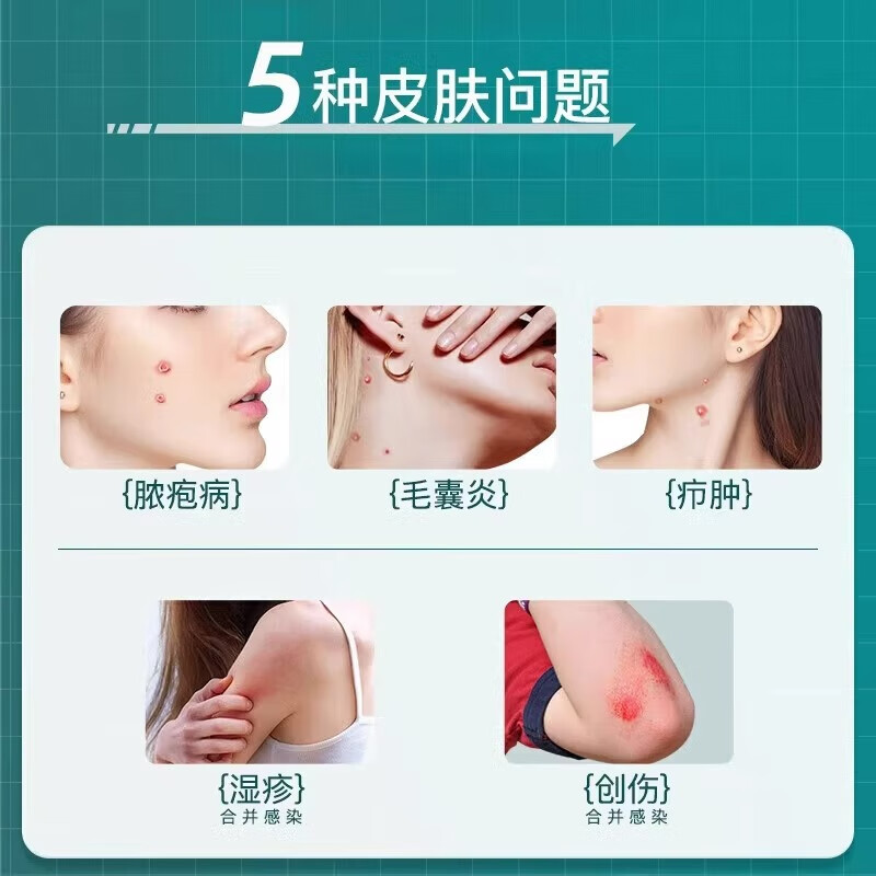 京丰制药 莫匹罗星软膏5g革兰阳性球菌引起的皮肤感染毛囊炎湿疹脓疱病、疖肿、毛囊炎等及湿疹合并感染 2盒+医用棉签