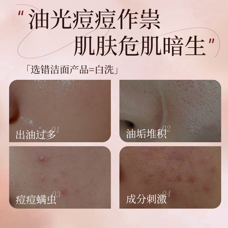 夫专家控油净透洁面乳女80g双重氨基酸清爽保湿护肤油皮专用洗面奶男士 【控油保湿】夫专家洁面乳80g