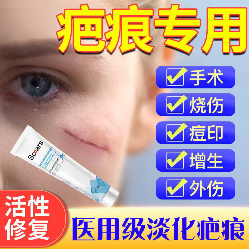 密丽除疤膏正i品郑州25克50g疤痕灵蜜利牌 一盒见效装 一盒见效装