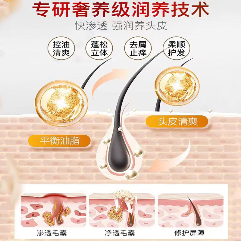 修正二硫化硒去屑洗发水头皮屑头痒头油毛囊痘头上长痘蓬松清爽500ml 1瓶【二硫化硒净透去屑洗发水】 500ml/瓶
