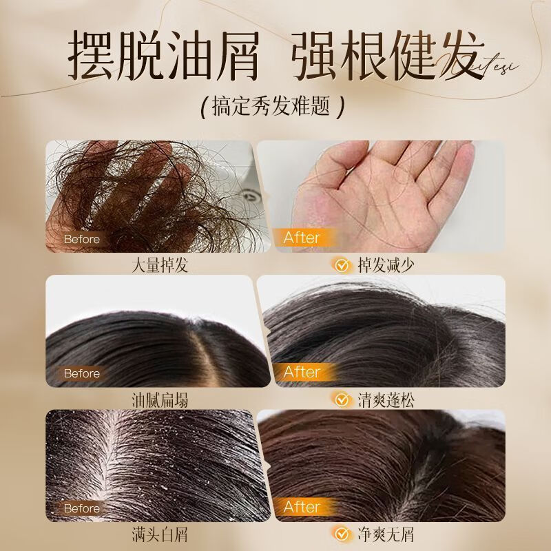 范泳辰防脱育发洗发水增发侧柏叶何首乌控油止痒洗头膏 【持证育发】500ml*2瓶