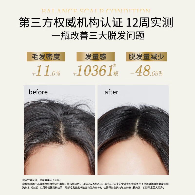 滋源控油去屑洗发水无患子清爽蓬松生姜防脱洗头膏男女士无硅油洗发露 防脱洗发水300g送400g