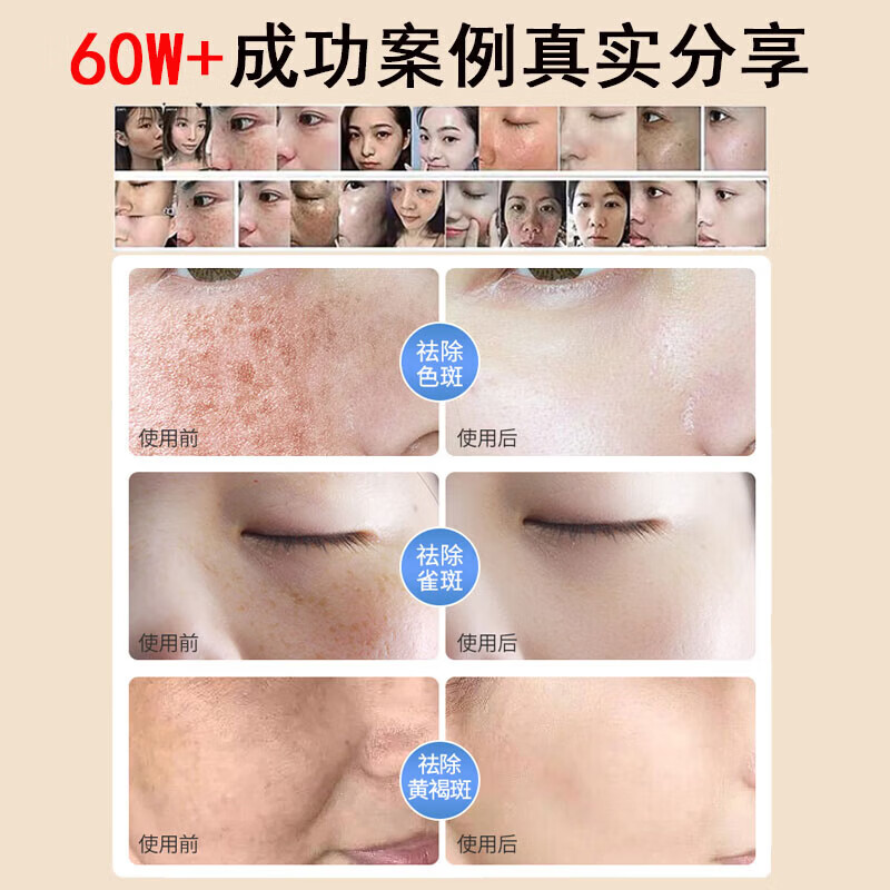 片仔癀祛斑霜美白淡化黑色素老年黄褐雀晒斑烟酰胺去黄提亮肤色男女面霜 1瓶【美白淡化】