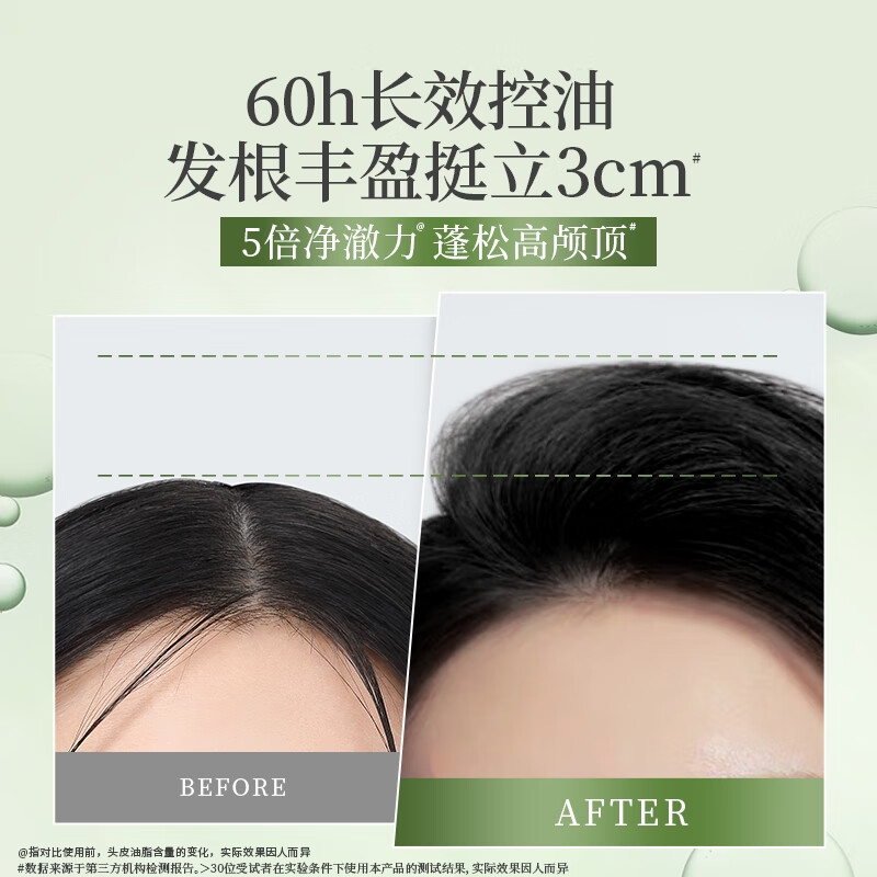 滋源控油去屑洗发水无患子清爽蓬松生姜防脱洗头膏男女士无硅油洗发露 控油蓬松洗发水300g送400g