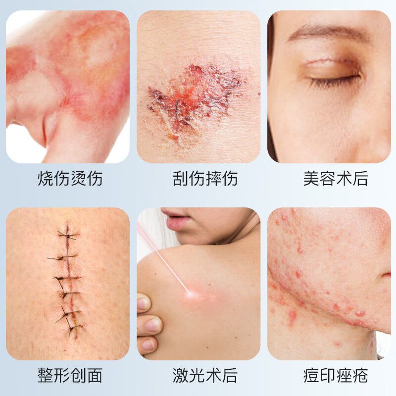 博益特外伤口快速生长愈合凝胶烫伤点痣割双眼皮壳聚糖肌褥疮修复急救包