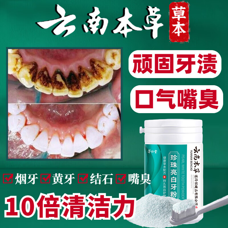 云南本草洗牙粉牙齿美白去黄去口臭去黄去牙渍去烟渍牙结石清洁牙垢洁牙粉 1瓶装50g【洗牙粉】
