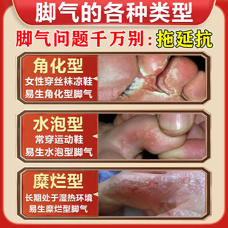 战立克脚气喷剂套装止痒脱皮烂脚丫真菌感染去水泡型脚痒脚汗脚臭喷雾根 【2盒装】足康喷剂套装