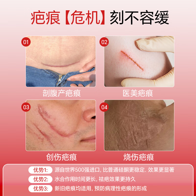 宫骏医生医用祛疤膏祛疤痕修复凝胶摔伤划伤去疤膏医用硅酮除疤膏手术缝针 3支装*30g【新老增生】