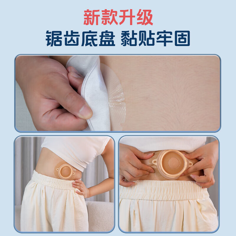 护士同学可排气造口袋二件式10386康L保两件式直肠医用一次性造口袋造瘘袋 锯齿平面底盘（5个）
