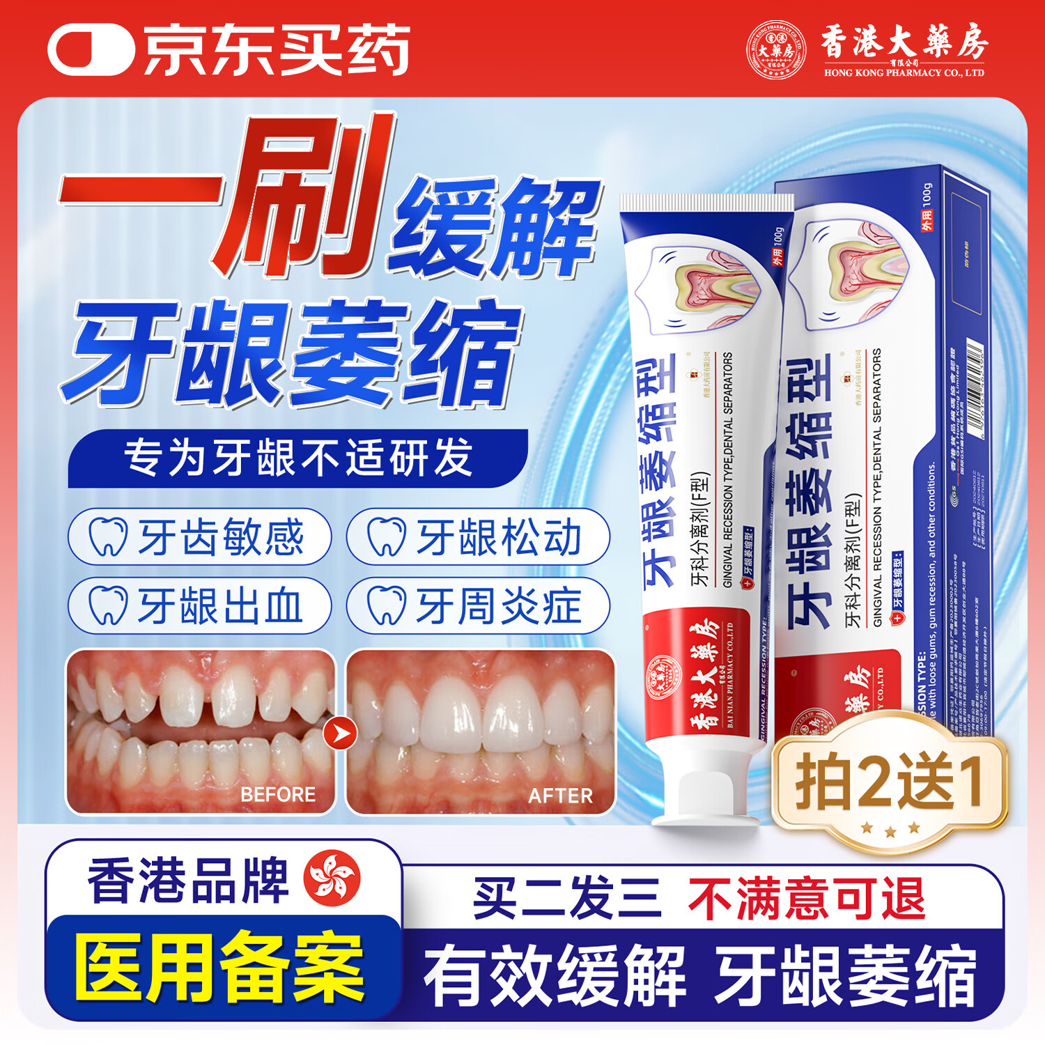 香港大药房有限公司牙龈萎缩专用牙膏状牙科分离剂牙周炎牙周炎症敏感