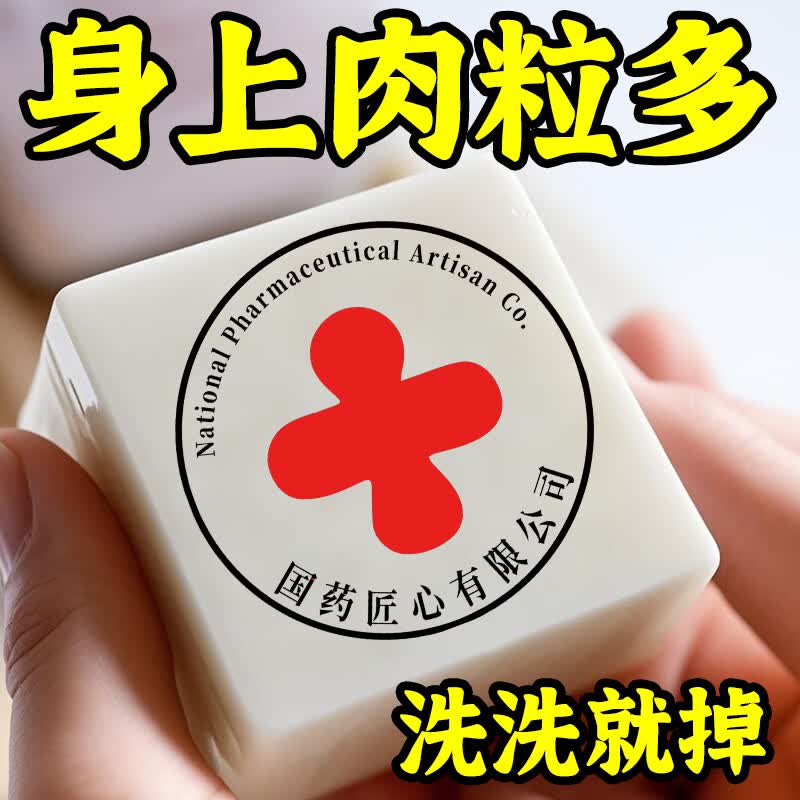 示博士【国药匠心去疣痣皂】全身小肉粒扁平尤丝状尤疣瘊抑菌祛疣香皂 【买2送1】标准升级装