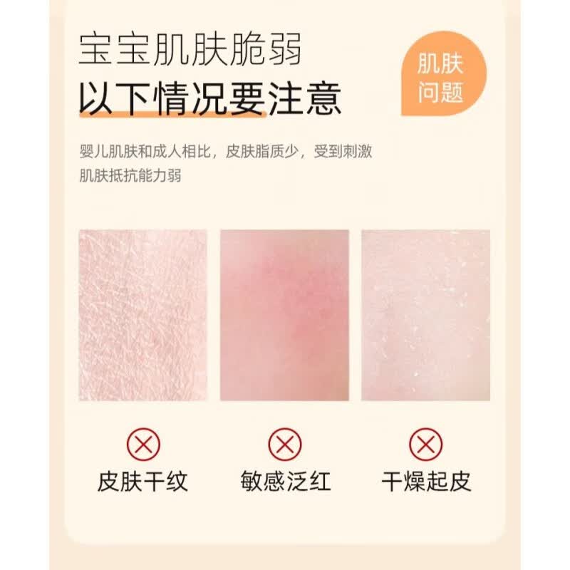 润根源儿童面霜抗氧面霜保湿润肤精华霜 贝星婴幼儿成人通用0-3岁 儿童保湿弹润面霜2瓶(全家用)