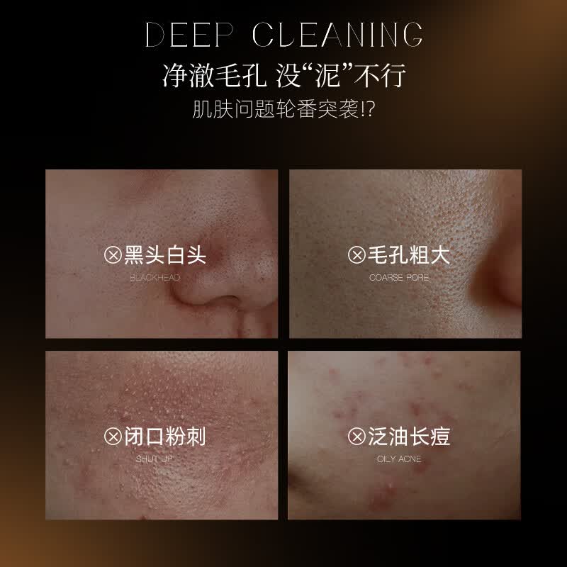 Nuilaa日本进口清洁泥膜去黑头粉刺细致毛孔清洁面膜涂抹式深层清洁毛孔 【黑头粉刺克星】泥膜单瓶装