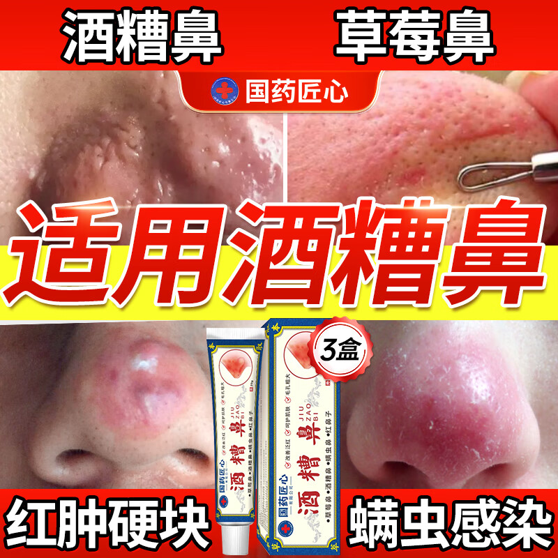 示博士酒糟鼻草莓鼻红肿玫瑰痤疮红鼻子专用去粉刺黑头红血丝螨虫修护软 三盒周期装（中度型） 搭红鼻子酒糟鼻头红肿消炎产品用