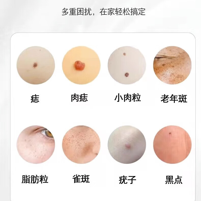 祥醫堂去疣点痣激光笔【可家用美容院同款】扫斑专用医用仪器蓝光修护神器除扁平丝状私处尖锐湿肉脂肪粒 15档+咪奎乳膏【点疣推荐】