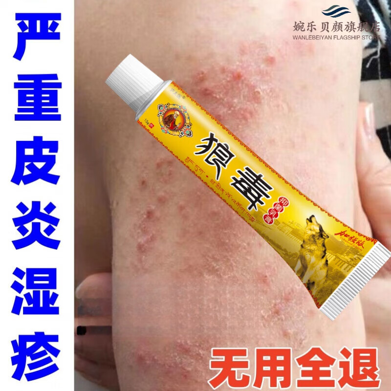 狼毒藥膏止癢皮膚濕疹止癢皮炎狼毒軟膏濕疹止癢去除外用根癢 買二贈一【三盒】 官方直售