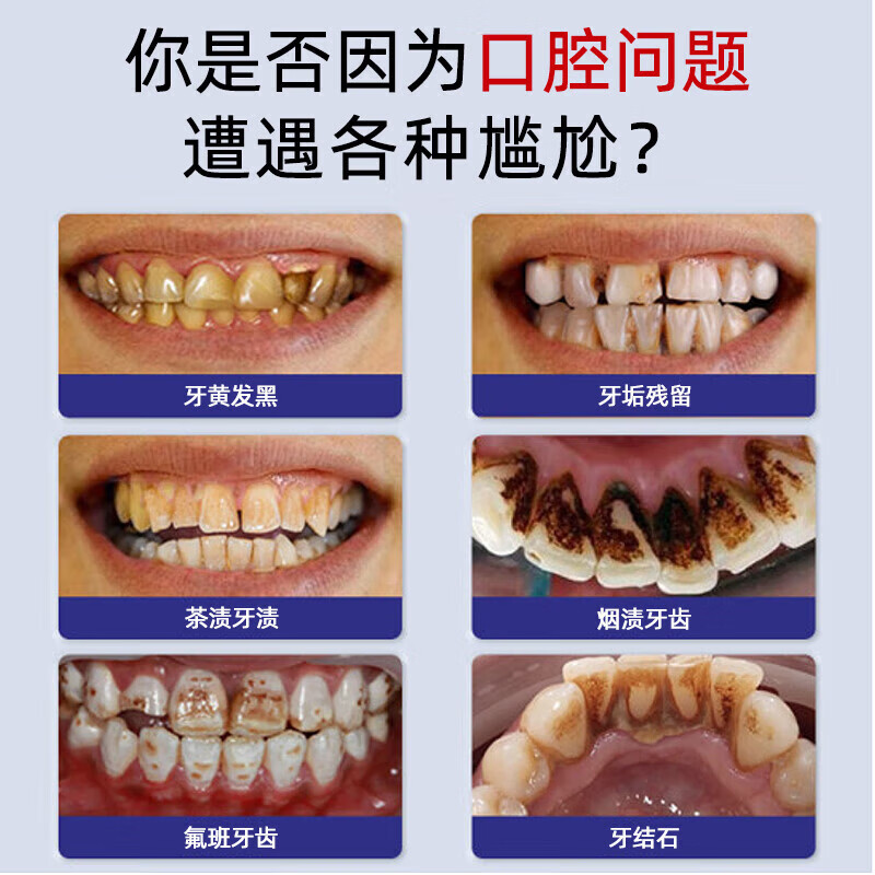 葵花美白牙膏去口臭去黄去牙渍去烟渍牙垢十大知名品牌含氟护龈 4支【7天去黄去渍-有效真测】