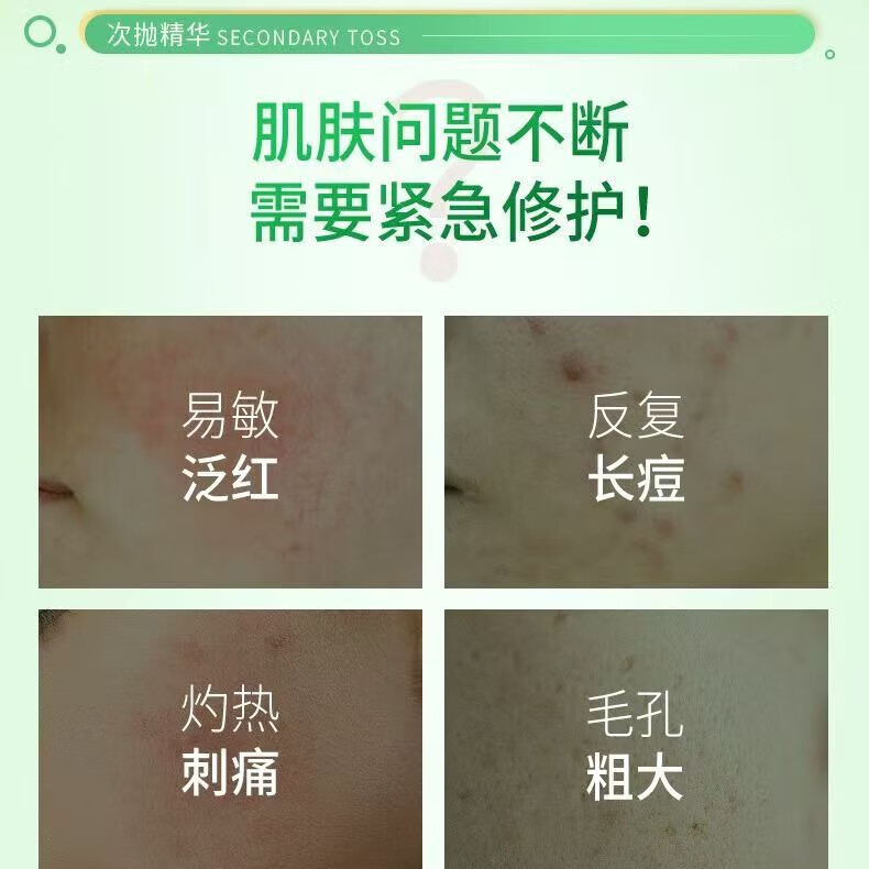 修正次抛精华液【修护】神经酰胺舒缓次抛精华液敏痘受损泛红30支/盒 3盒【神经酰胺舒缓次抛精华液】 30支/盒