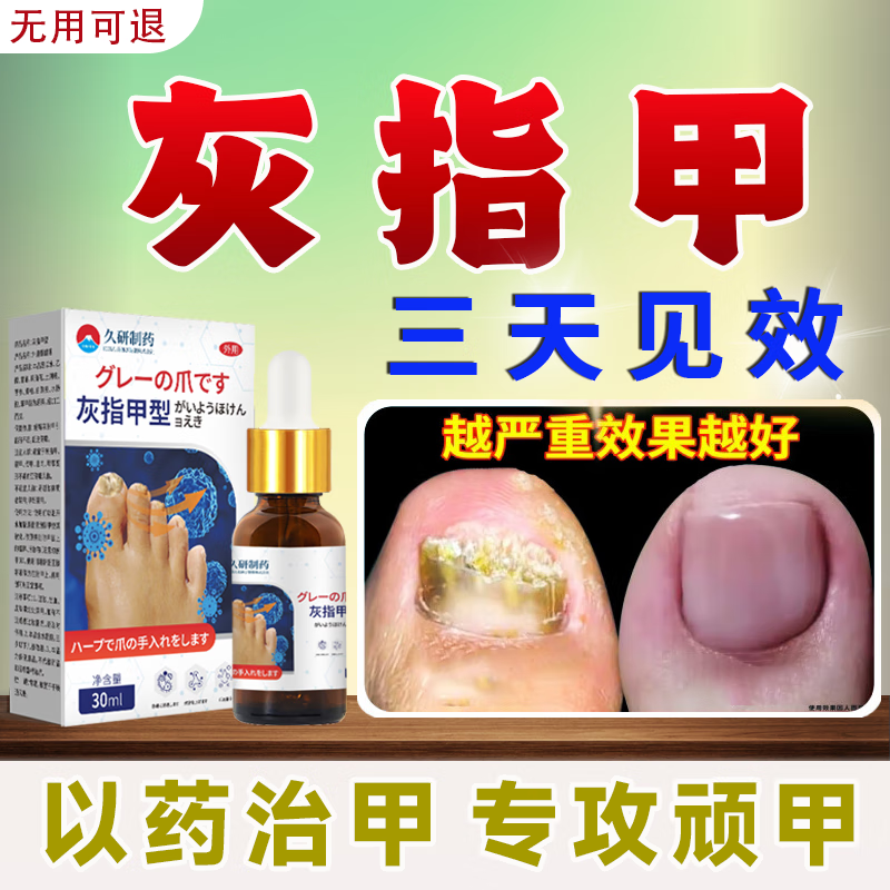 久研制药日本灰指甲特傚效药第1名正品增厚发黄变空中沟草炎药进口抑菌液 一瓶【体验装】