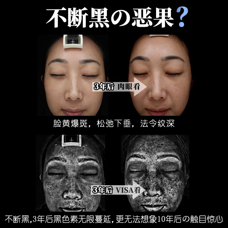 小野拓司幹细胞断黑·碳酸灌肤面膜 1次=3次高端项目 瓷光雪白少女肌 1瓶·初体验 送刮板:上脸+卸脸