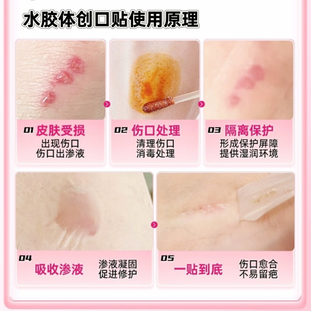 菩乐家水胶体创可贴防水儿童医用防抠透气婴儿针孔洗澡贴隐形透明创口贴 【京东物流】水胶体创口贴9贴装