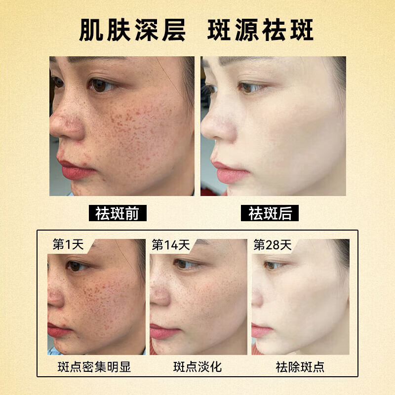 片仔癀祛斑霜美白淡化黑色素老年黄褐雀晒斑烟酰胺去黄提亮肤色男女面霜 1瓶【美白淡化】