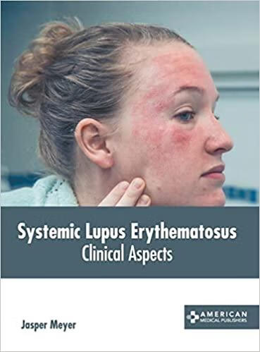 预订systemic lupus erythematosus: clinical aspects