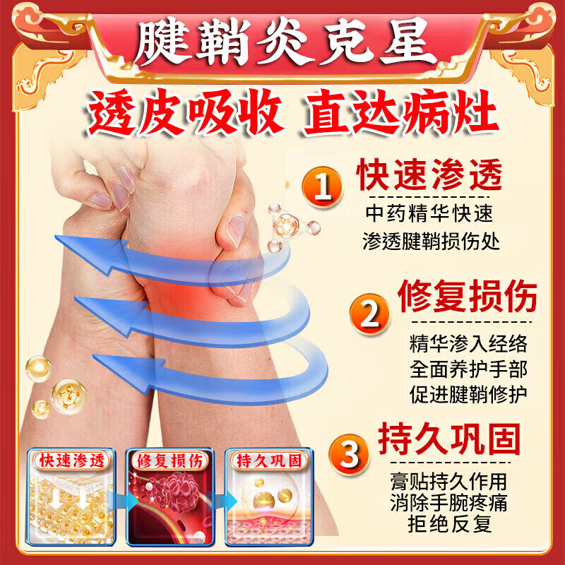 冈藤制药腱鞘炎100%膏药热敷贴手腕手指大拇指疼痛囊肿鼓包专用正品凝胶药 特效组合3盒喷剂+3盒贴 双管齐下