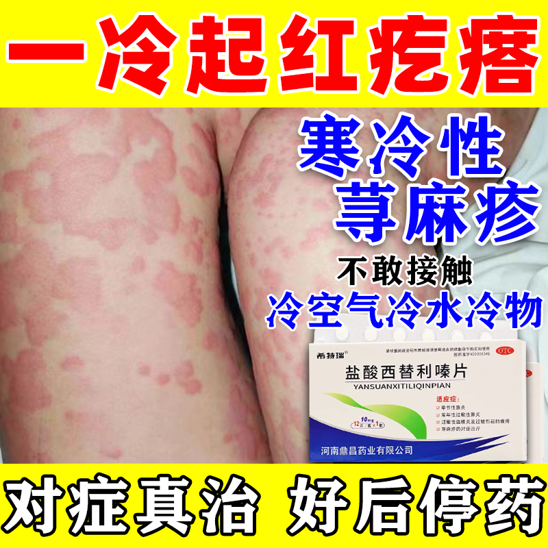 荨麻疹寒冷性荨麻疹药膏 抗过敏药慢性荨麻疹口服药盐酸西替利嗪片 1