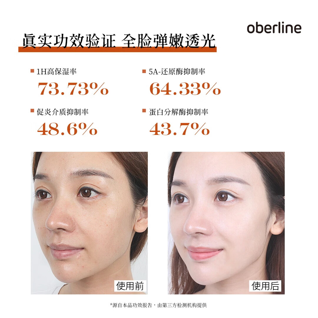 奥贝兰【颖儿同款】水乳霜套装保湿补水抗皱紧致初老焕白去黄提亮控油 【5件套】水乳+精华液+霜+湿敷水