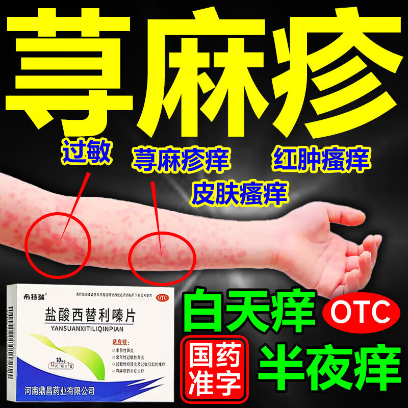 慢性荨麻疹增强发货免疫力低 盐酸西替利嗪片 1