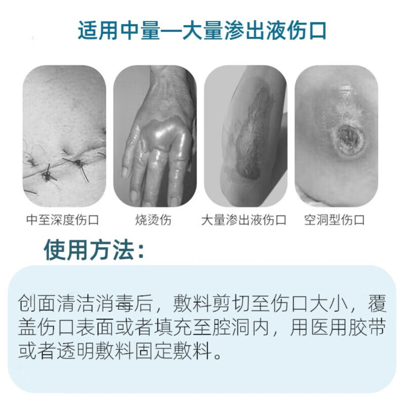 菩乐家藻酸盐敷料医用伤口褥疮压疮肛瘘空洞溃疡糖尿足窦道填充条吸渗液 藻酸盐1片
