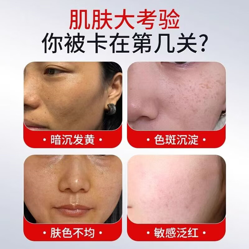 时珍世家 金系列医用烟酰胺凝凝胶美白淡斑霜改善淡化祛黑色素去老年斑雀斑乳霜 【古校长】医用烟酰胺凝凝胶 8支【巩固装】多买多实惠