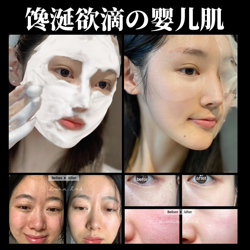 小野拓司幹细胞断黑·碳酸灌肤面膜 1次=3次高端项目 瓷光雪白少女肌 1瓶·初体验 送刮板:上脸+卸脸