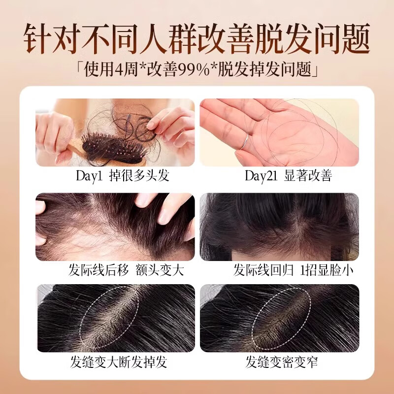 七味堂防脱洗发水胖东来严选生姜育发洗发露增长头发旗舰控油去屑固发店 5瓶装【毛囊滋养】健发丰盈