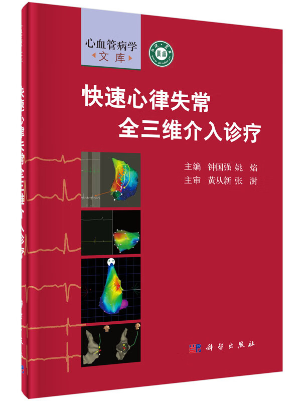快速心律失常全三维介入诊疗