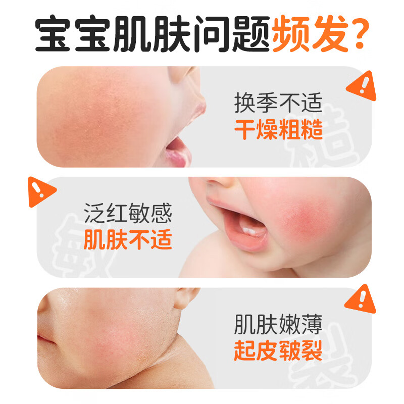 袋鼠杰克儿童成人面霜沙棘保湿滋润霜防皴裂舒缓补水润肤四季可用婴儿面霜 【保湿锁水】沙棘滋润保湿霜*1瓶