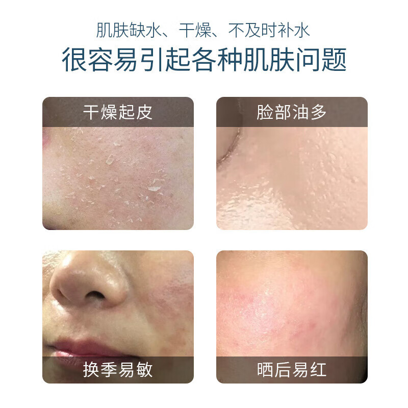 LELNIA玻色因补水喷雾补水保湿清爽不油腻护肤品男女士通用爽肤水 【到手3瓶】玻色因补水喷雾150ml