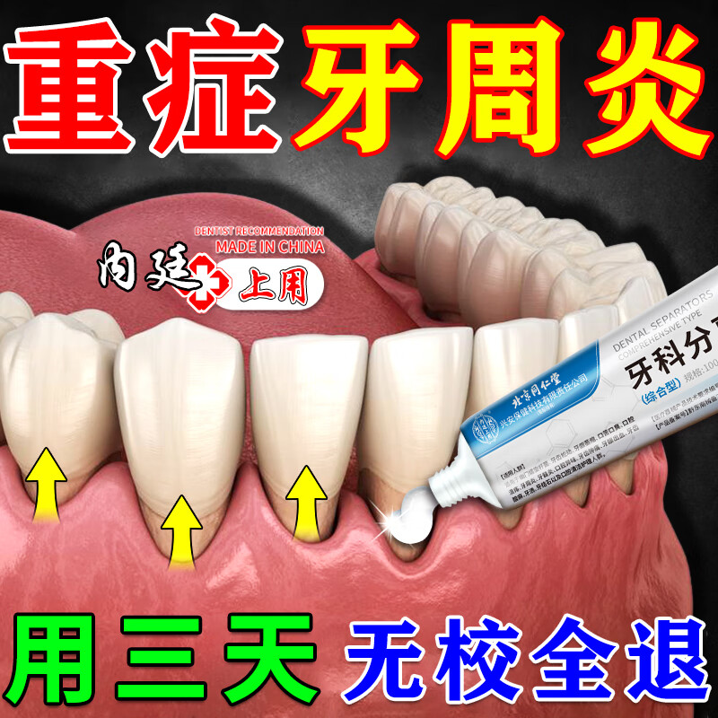 内廷上用牙周炎专用牙膏牙龈炎牙龈肿痛牙齿松动固齿修复牙龈萎缩专用