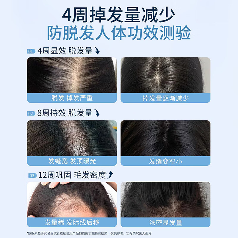 ZGEG防脱洗发水防断蓬松防脱强韧健发滋润头皮清屑防痒去污洗发露 【79/瓶】洗发水*2中度脱发适用
